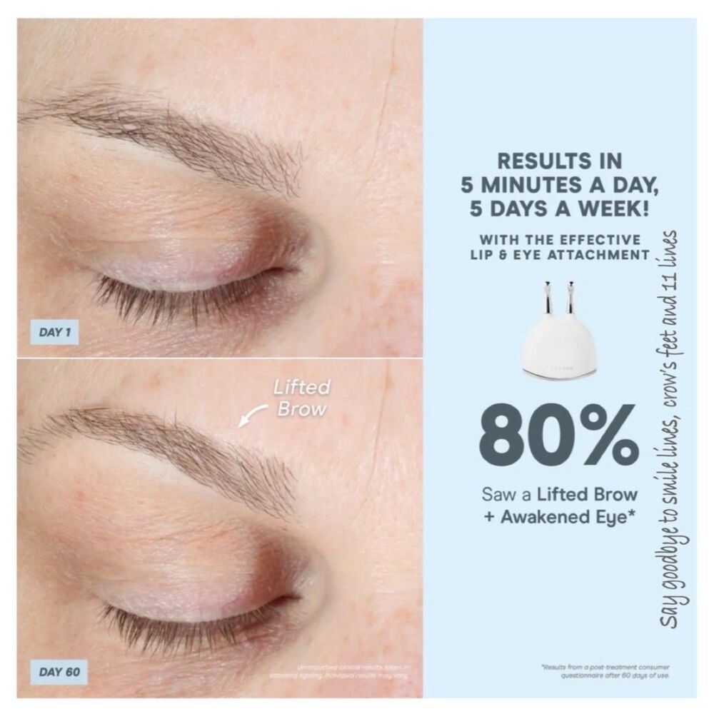 Nuface Trinity+ Boost w/ Effective Lip & Eye Attachment & Activator Gel - Picture 7 of 7